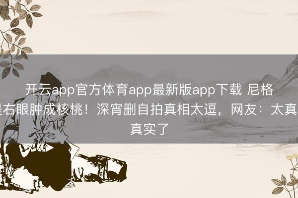 开云app官方体育app最新版app下载 尼格买提右眼肿成核桃！深宵删自拍真相太逗，网友：太真实了